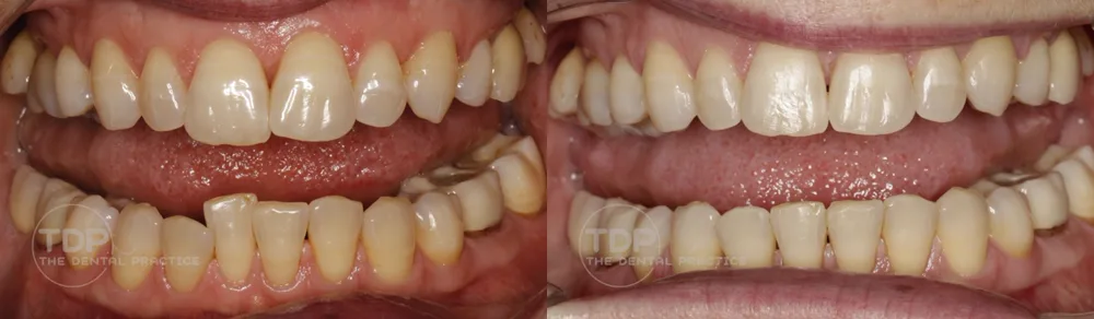 A patient before and after cosmetic treatment