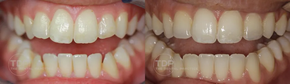 A patient before and after cosmetic treatment